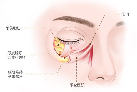 老的标志去除眼袋焕发青春光彩j9九游会登录眼袋不是自然衰